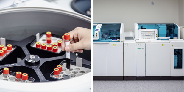 Female fertility testing at Seoul Miz IVF and Fertility Hospital in Seoul, South Korea